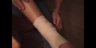 Staceys Florida Gals Next Door - Twisted Ankle Sprain